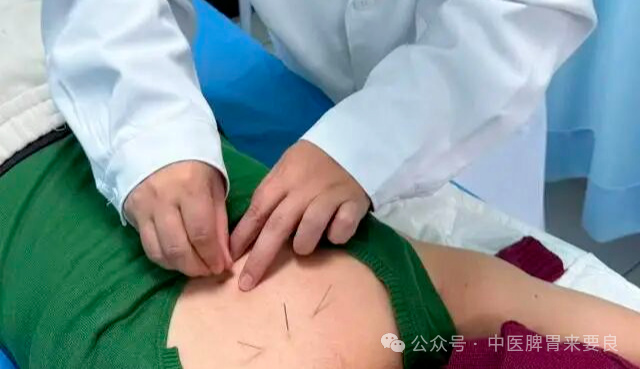 胃病无小事，针灸可治疗！让你的胃轻松自在！