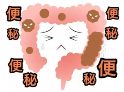 便秘如何快速排便？