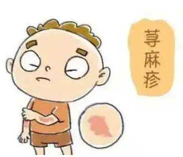 荨麻疹会传染吗？