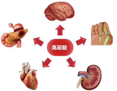 高尿酸血症患者如何饮食？
