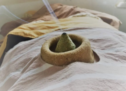 脐灸的功效和作用有哪些？