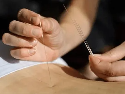 腹针减肥效果怎么样？
