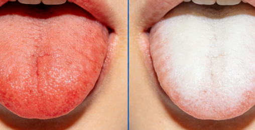 不怕舌头红，就怕&ldquo;舌头白&rdquo;，说明阳气已经大虚！教你4招改善阳虚，寒湿