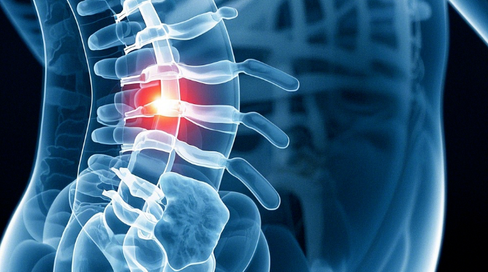 腰椎间盘突出后这5点一定要注意！