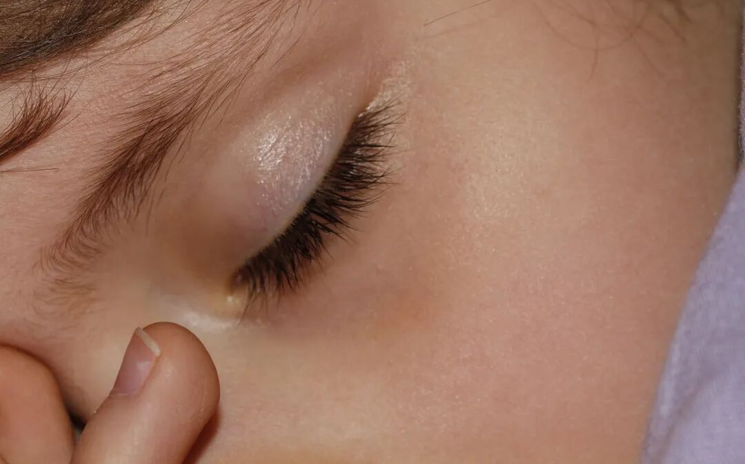 眼干眼涩、视物模糊，不妨试试这个中成药，补益肝肾、明目养精