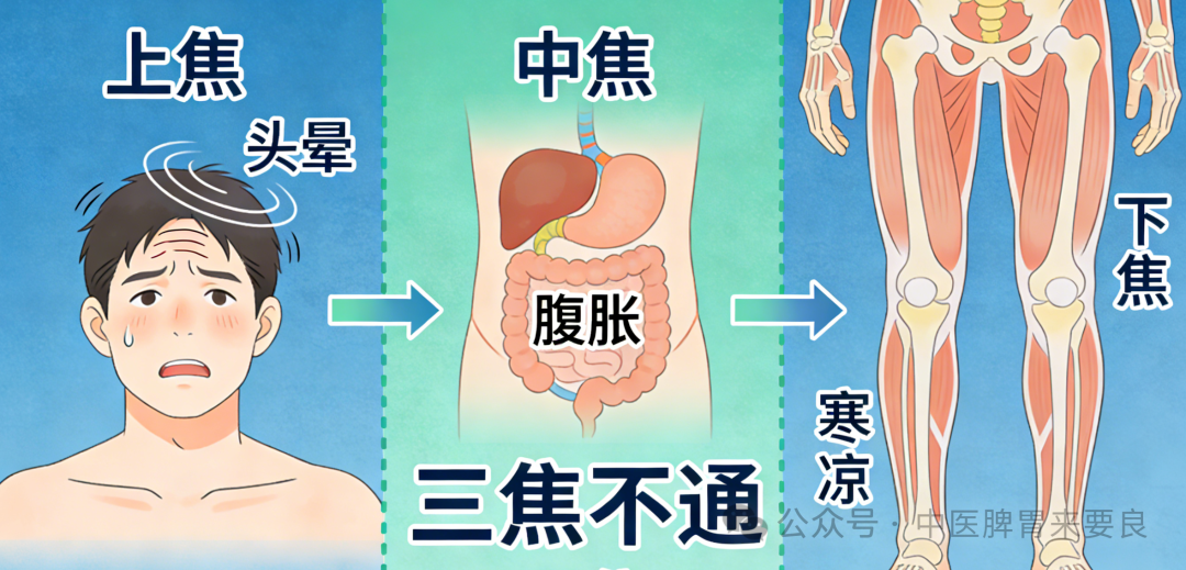 三焦不通，寒热错杂！上焦堵头晕，中焦堵腹胀、下焦堵寒凉，这3个中成药，打通三焦，全身轻松